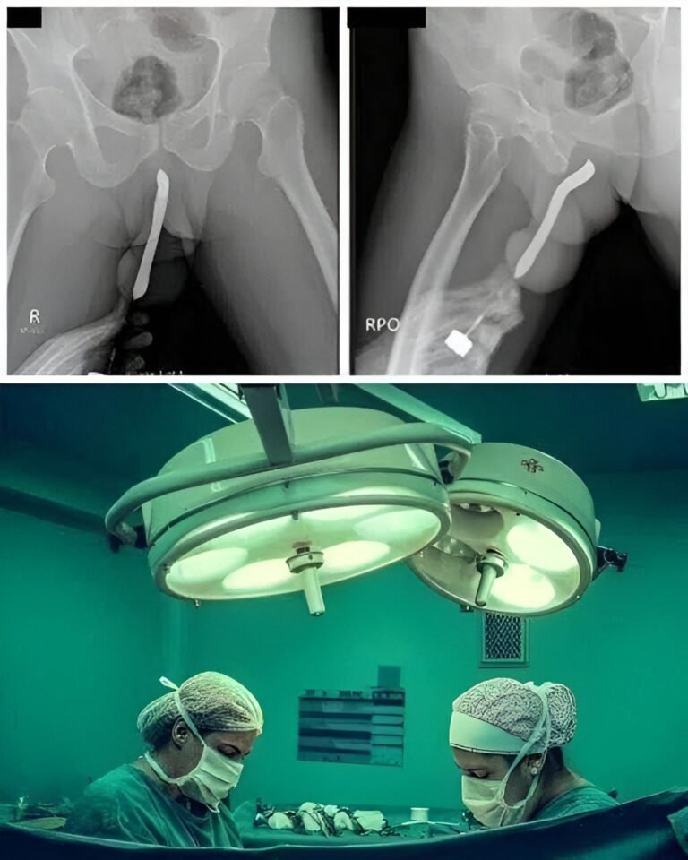 Girl had to be hospitalized for wanting to use a pe..
