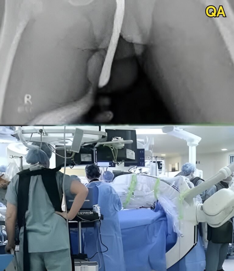 Girl had to be hospitalized for wanting to use a pe…See more