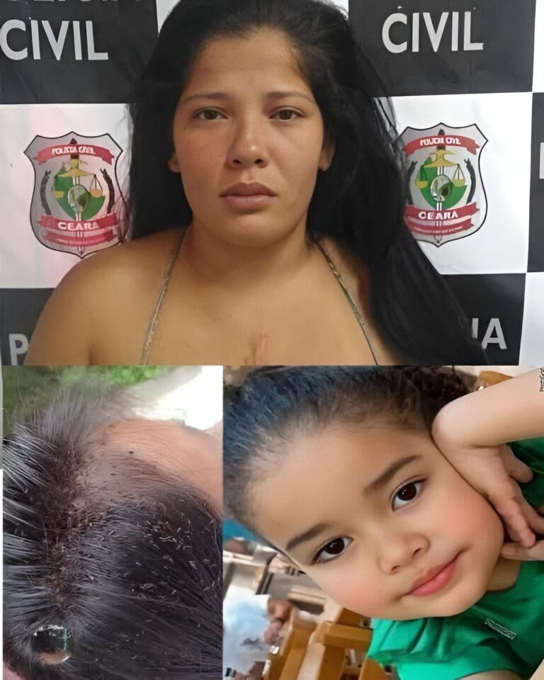3-year-old girl after lice and mother warns… See More