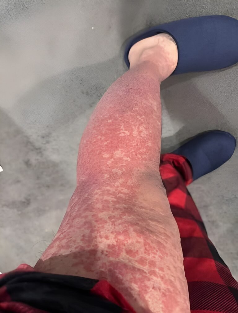 These are the consequences